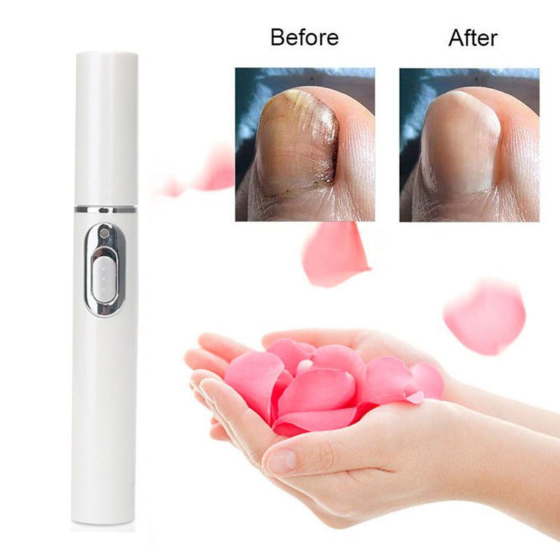 Effective Laser Remedy for Fungal Nails - Reliable Solution for Comprehensive Treatment