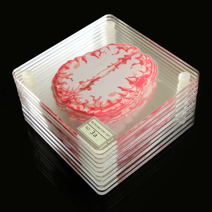 Unique Brain Slice Acrylic Coasters for Drinks and Decor - Set of TenCoastersNormanharvey