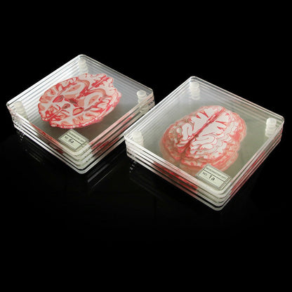 Unique Brain Slice Acrylic Coasters for Drinks and Decor - Set of TenCoastersNormanharvey